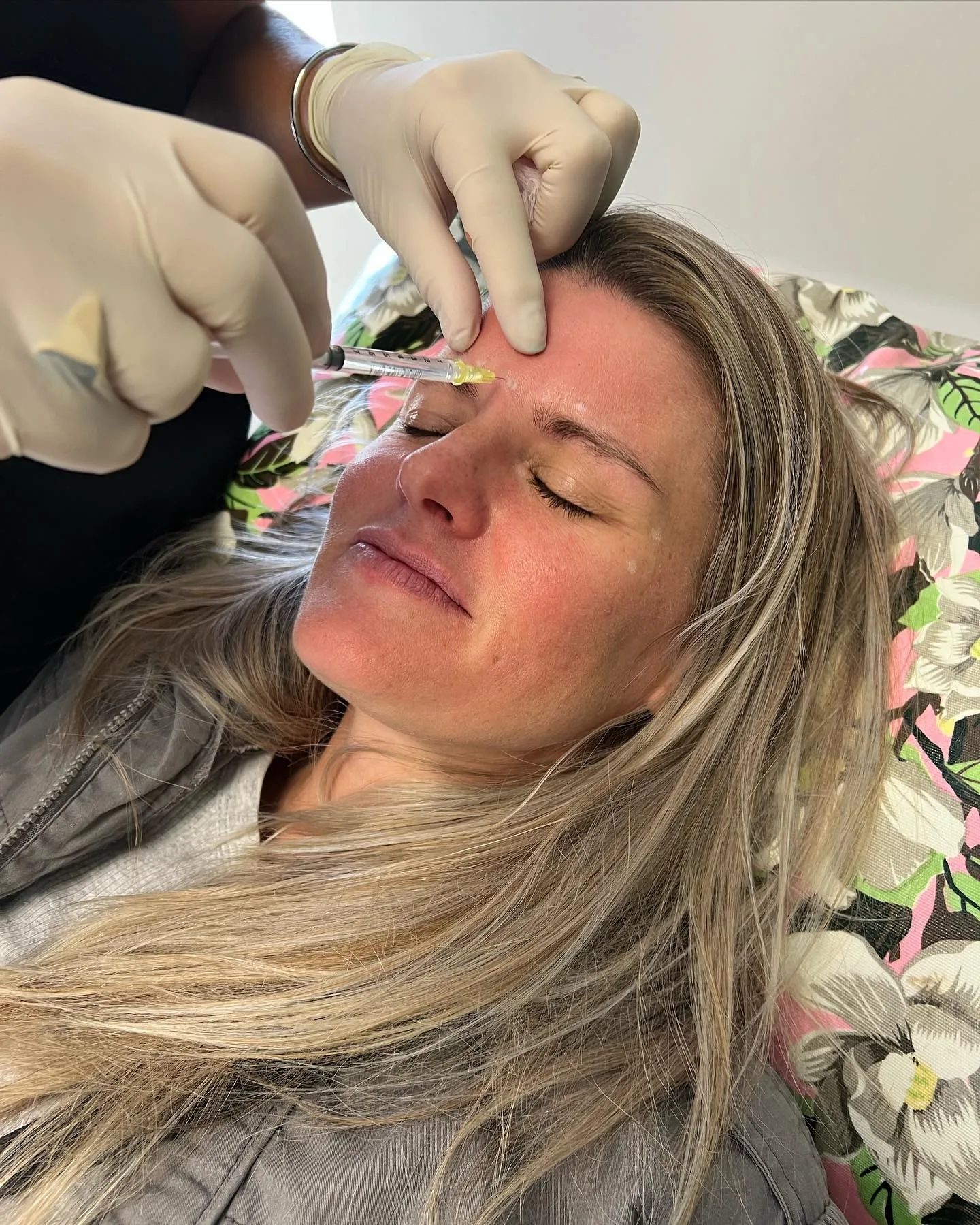 Patient receiving aesthetic treatment at Dr. Susan F. Johnson's practice